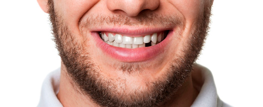 ¿Por qué se producen pérdidas dentales?